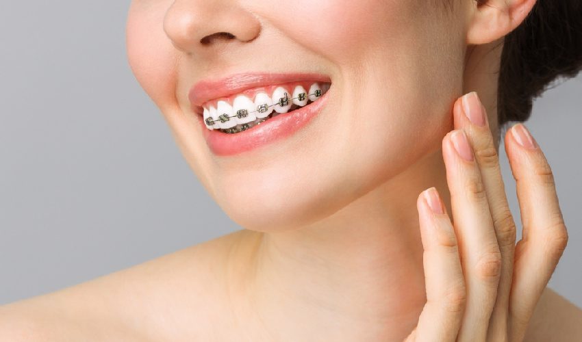 Orthodontic Treatment Benefits