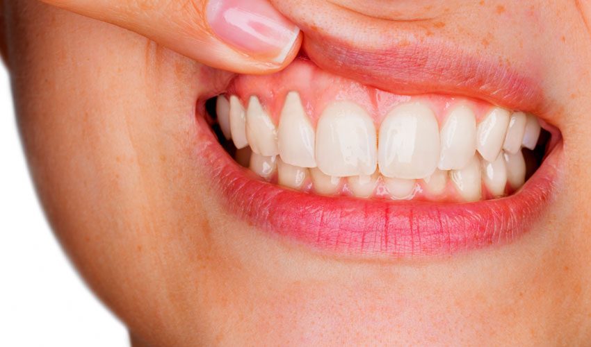 treating-oral-and-gum-problems